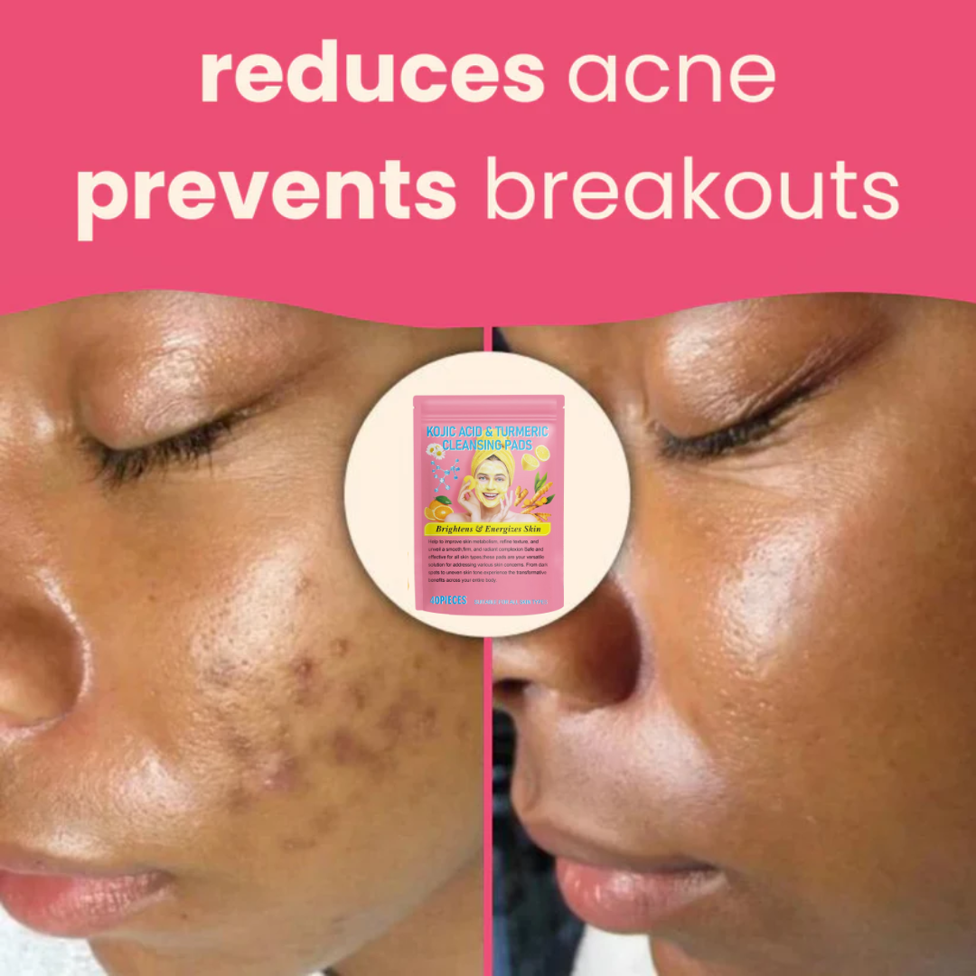GlowPads™ Turmeric & Kojic Acid Cleaning Pads