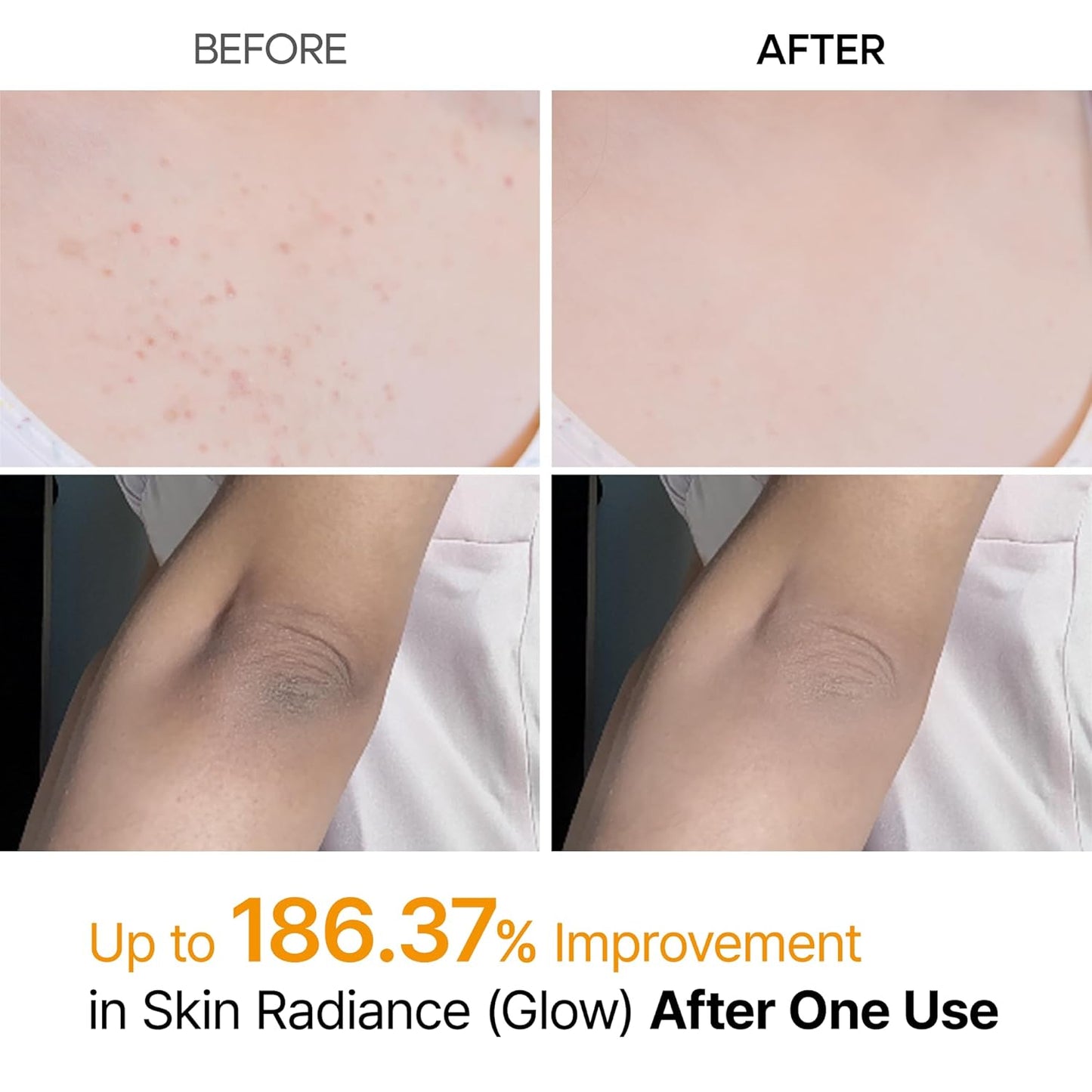 Peel Shot Kojic Acid Turmeric Spray