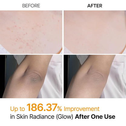Peel Shot Kojic Acid Turmeric Spray