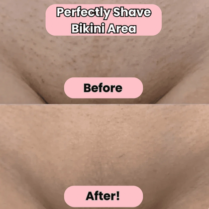 SilkTouch™ 2 in 1 Lady Shaver